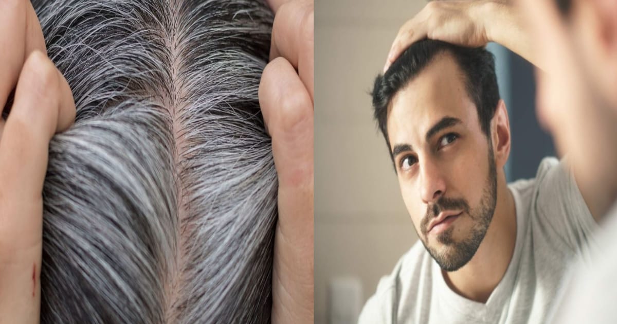 foods-to-produce-melanin-and-prevent-hair-graying-know-solution